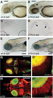 Tissue-Specific Requirement for the GINS Complex During Zebrafish Development